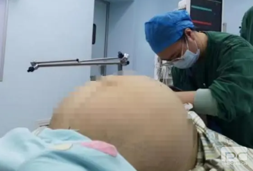 23岁女孩腹胀如鼓，手术后取出42斤肿瘤！！！